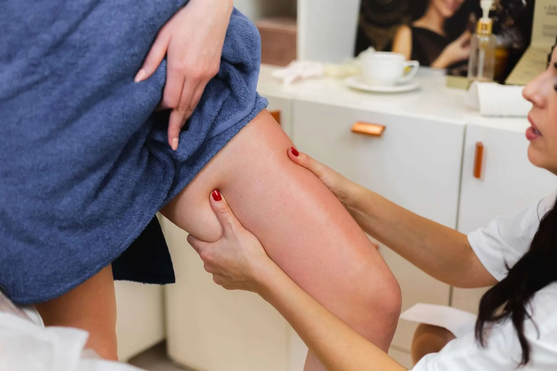 Leg with signs of deep vein thrombosis, including swelling and redness.